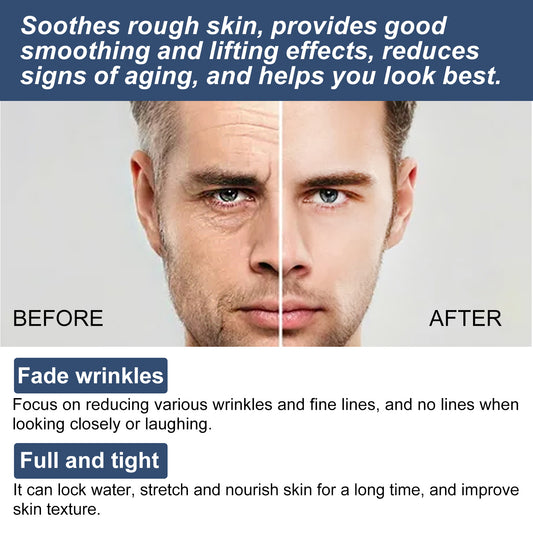 East Moon 6-in-1 Face Cream — Fine Lines, Bags & Dark Circle Fix
