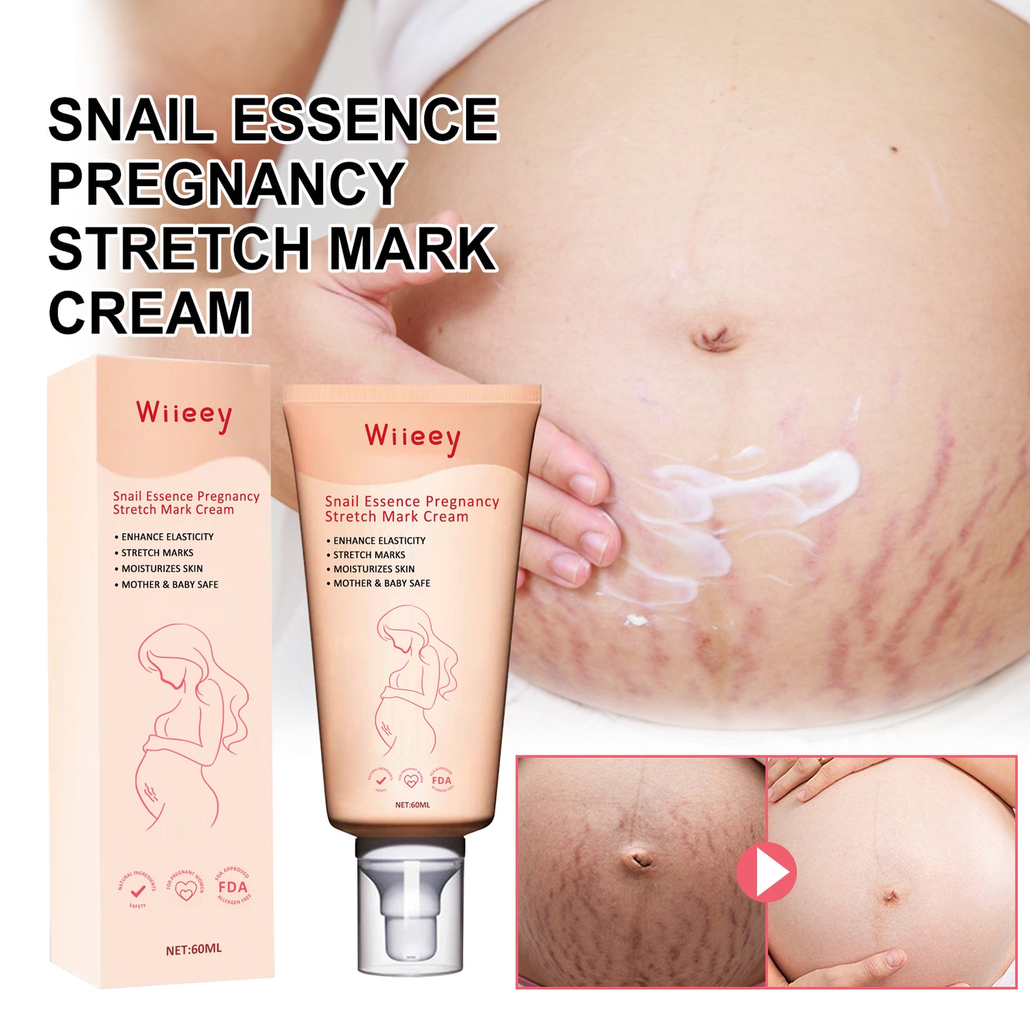Snail Essence Pregnancy Stretch Mark Cream, Firming Skin Repair Lighten Postpartum Pregnancy Marks And Gestational Fat Smoothing Cream