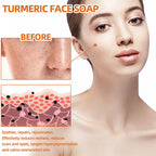 Turmeric Cleansing Face Soap