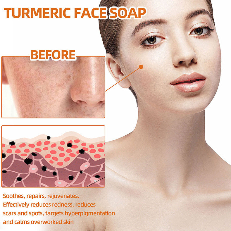 Turmeric Cleansing Face Soap