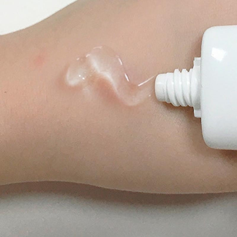 Blackhead Removal & Acne Scar Gel