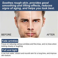 East Moon 6-in-1 Face Cream — Fine Lines, Bags & Dark Circle Fix