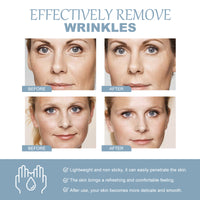 WIYUN Hyaluronic Acid Firming Face Cream For Reducing Fine Lines, Anti-Wrinkle Moisturizing And Firming Skin Care Cream