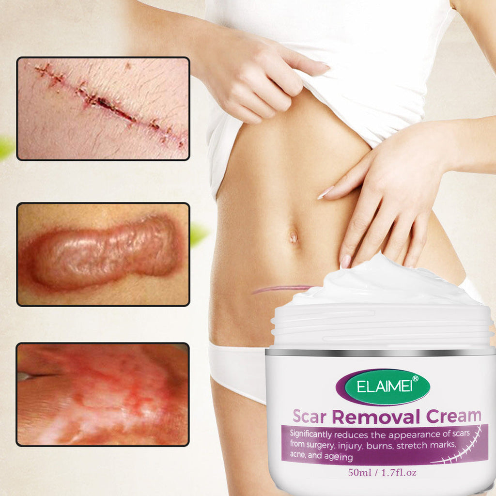 Scar & Stretch Mark Repair Cream