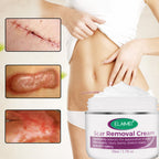 Scar & Stretch Mark Repair Cream