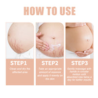Snail Essence Pregnancy Stretch Mark Cream, Firming Skin Repair Lighten Postpartum Pregnancy Marks And Gestational Fat Smoothing Cream