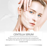Hoygi Centella Essence Tightens And Moisturizes Skin, Moisturizes, Hydrates And Brightens Daily Facial Skin Care Essence