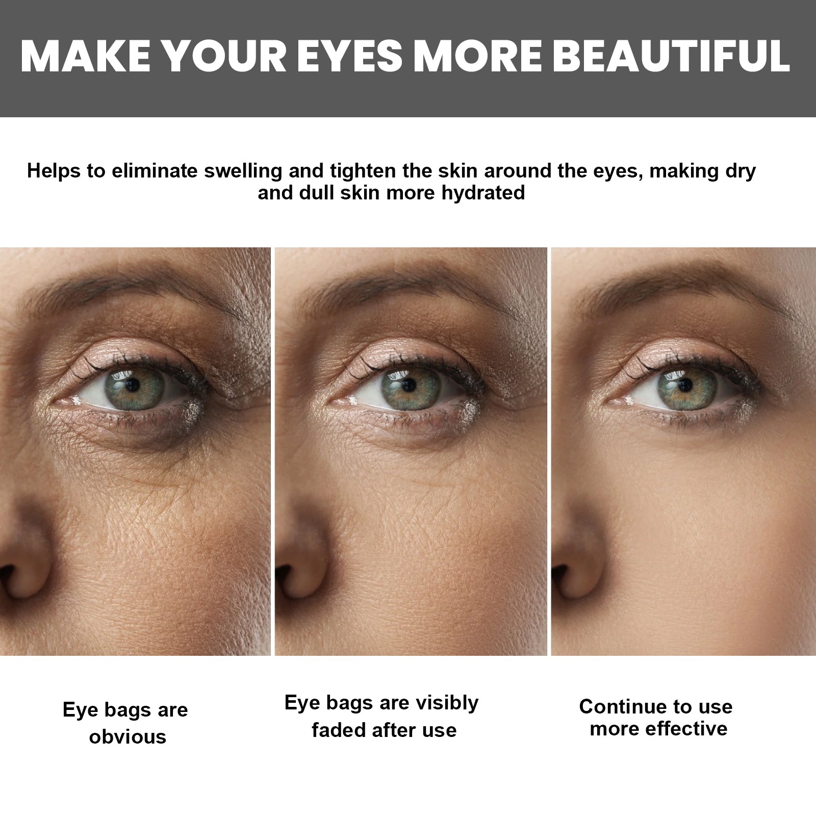 EELHOE Collagen Hyaluronic Acid Massager Eye Cream For Fine Lines And Delicate Skin Care Eye Cream