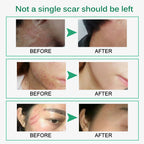 Scar & Stretch Mark Repair Cream