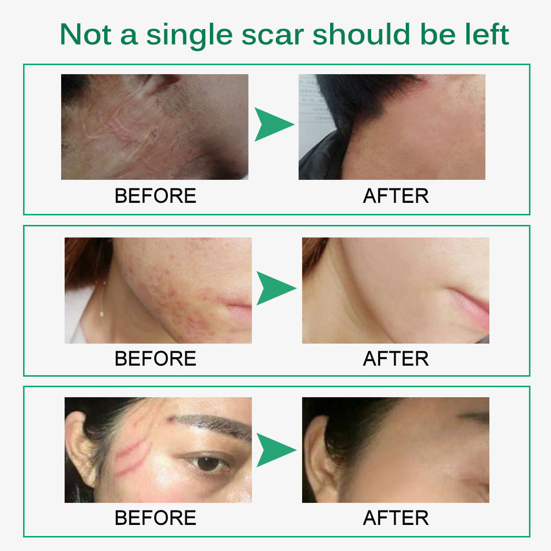 Scar & Stretch Mark Repair Cream