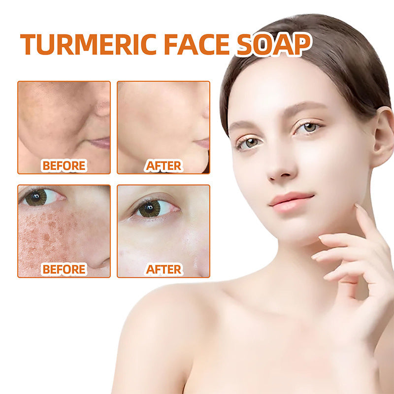 Turmeric Cleansing Face Soap