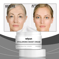 Hyaluronic Acid Moisturizing Moisturizer, Improves Skin Elasticity And Moisturizes Skin Daily Care Cream