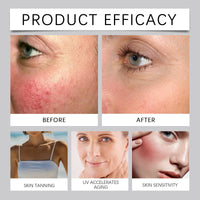 Hyaluronic Acid Skin Care, Outdoor Uv Protection Multi-Functional Isolation Skin Gentle Moisturizing Protective Cream