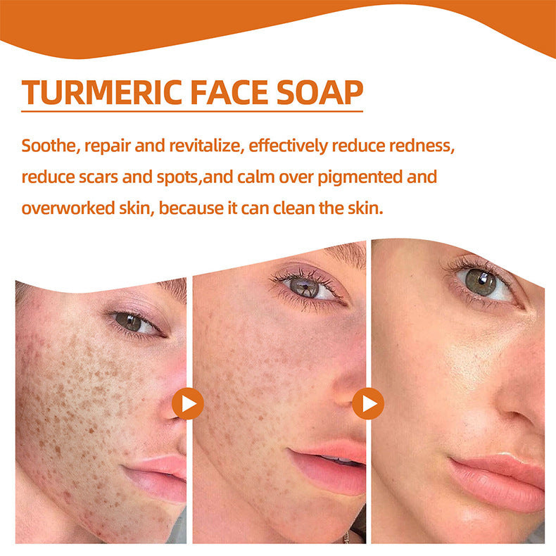 Turmeric Cleansing Face Soap
